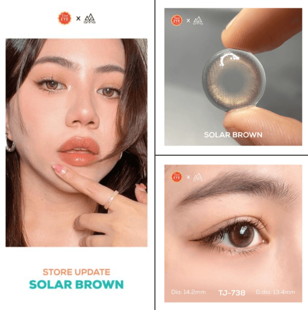 Nên lưu ý gì khi đeo lens sau mổ cận?