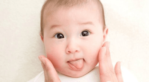 Biểu hiện của bệnh mắt lác ở trẻ em