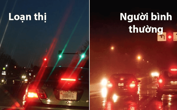 Loạn thị là tình trạng như thế nào?