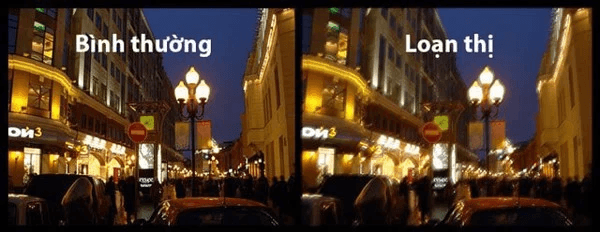 Những ảnh hưởng của loạn thị đến thị lực