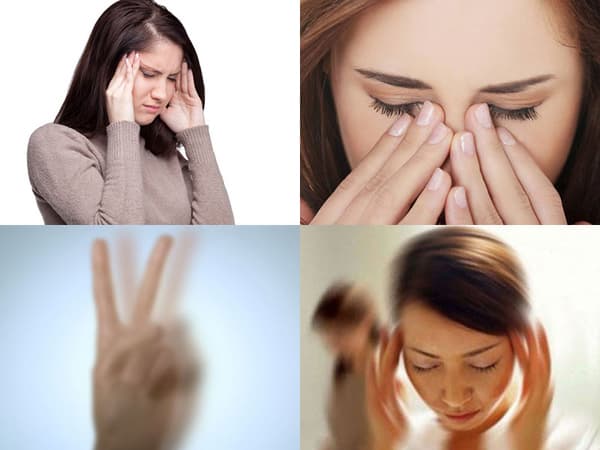 Loạn thị nặng