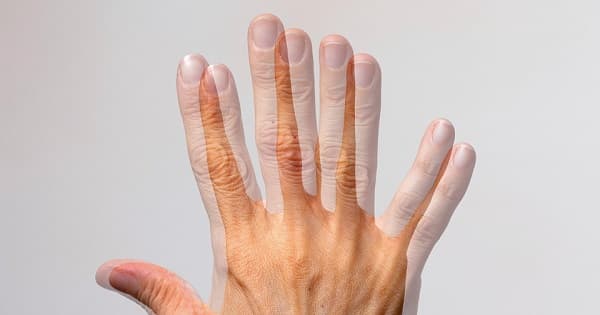 Bạn cần đi khám và đo mắt khi gặp tình trạng nhìn lóa/tầm nhìn đôi
