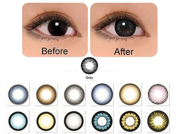 Lens mắt là gì?