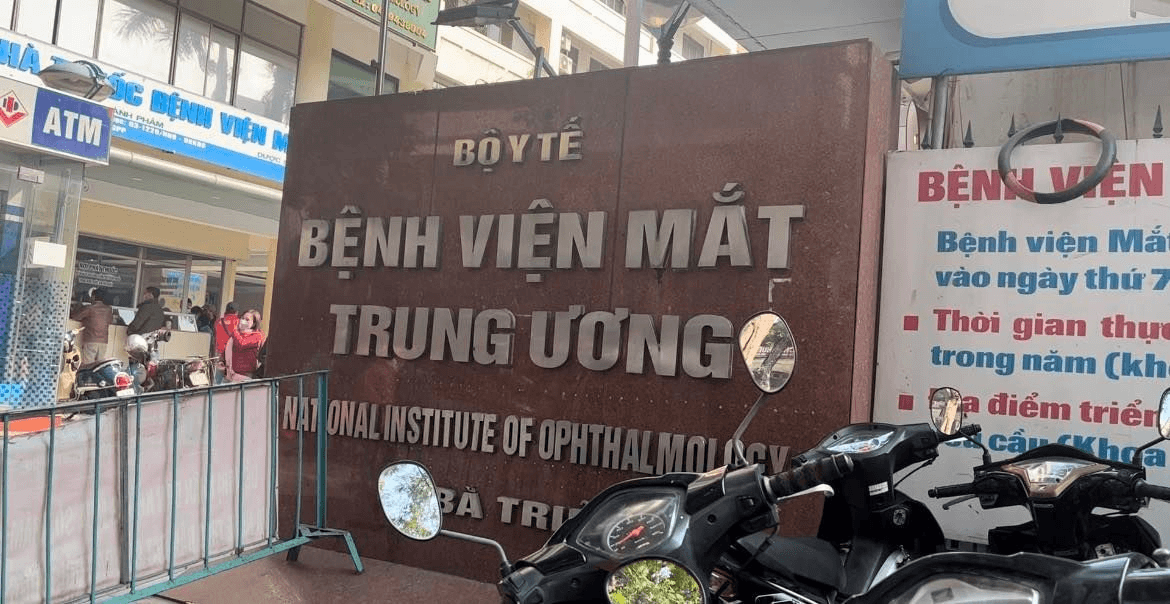 Chi phí mổ lác ở bệnh viện mắt Trung Ương