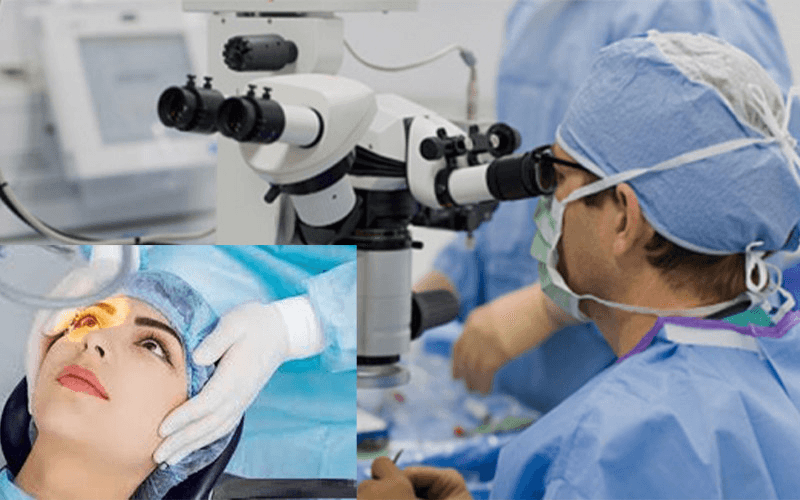 Chi phí mổ mắt lác bao nhiêu tiền?