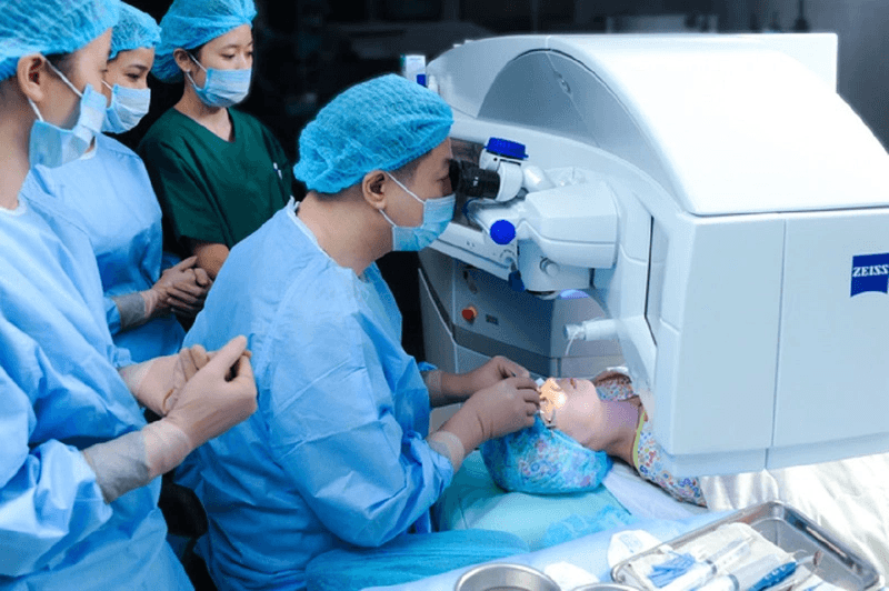 Chi phí mổ lác ở bệnh viện mắt Trung Ương