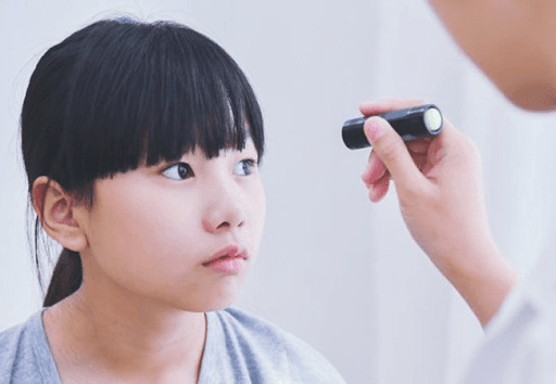 Dấu hiệu bé bị lác mắt chuẩn nhất cha mẹ nên biết