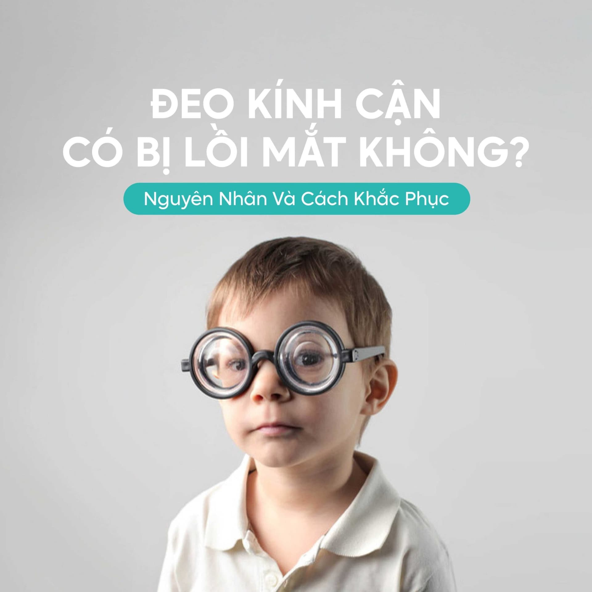 Đeo kính cận có bị lồi mắt không? Nguyên nhân và cách khắc phục