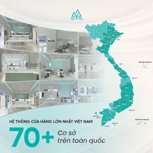 Kính mắt Anna có bao nhiêu cửa hàng?